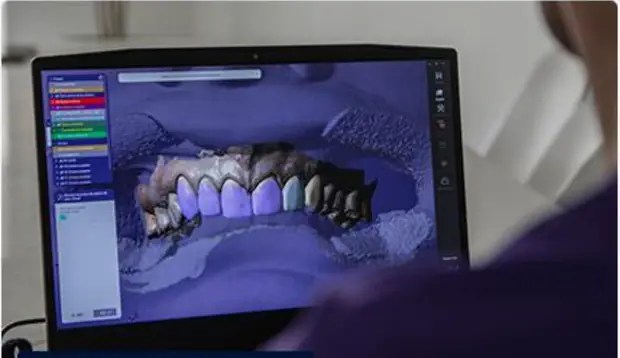 Diseño digital de sonrisa en pantalla